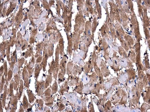 GSTM1 Rabbit Polyclonal Antibody