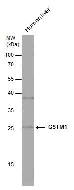 GSTM1 Rabbit Polyclonal Antibody