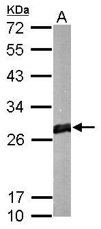 GSTM1 Rabbit Polyclonal Antibody
