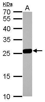 GSTM1 Rabbit Polyclonal Antibody
