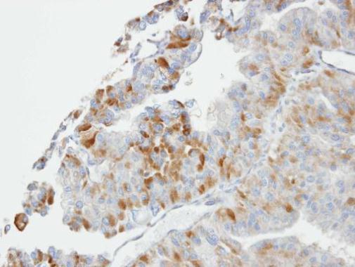 GSTO1 Rabbit Polyclonal Antibody