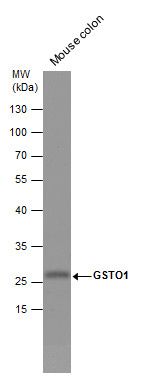 GSTO1 Rabbit Polyclonal Antibody