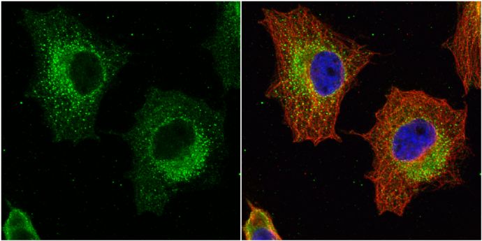GSTP1 Rabbit Polyclonal Antibody