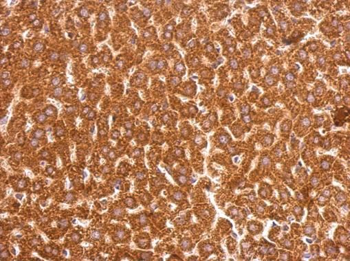 GSTP1 Rabbit Polyclonal Antibody