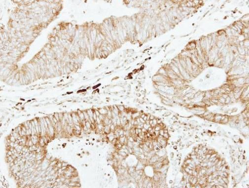 GSTP1 Rabbit Polyclonal Antibody