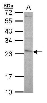 GSTP1 Rabbit Polyclonal Antibody