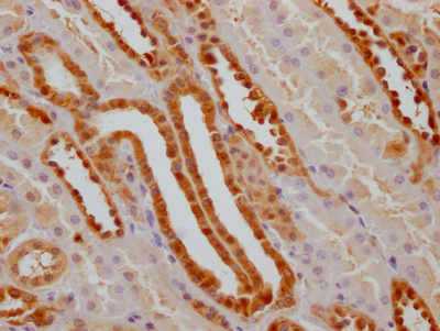 GSTP1 Antibody
