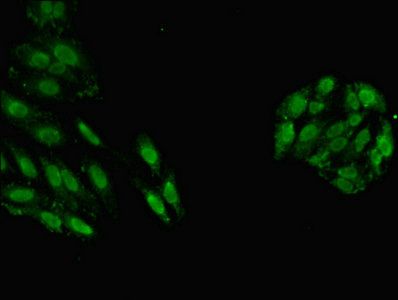 GSTT1 Antibody