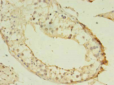 GSTT1 Antibody