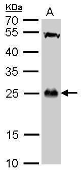 GSTT1 Rabbit Polyclonal Antibody