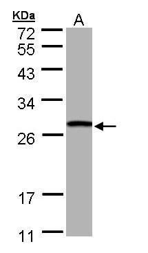 GSTT1 Rabbit Polyclonal Antibody