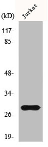 GSTT1 Antibody