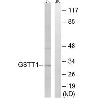 GSTT1 Antibody