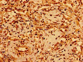 GSX1 Antibody