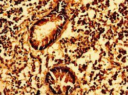 GSX1 Antibody