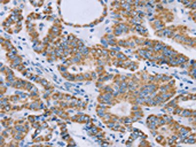 GUCY1A1 Antibody