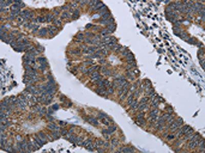 GYPC Antibody