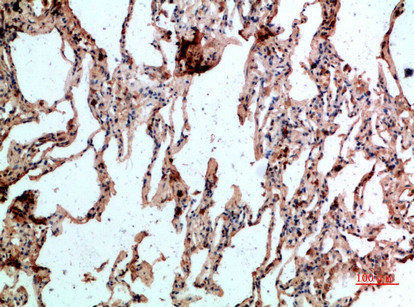 GYPC Antibody