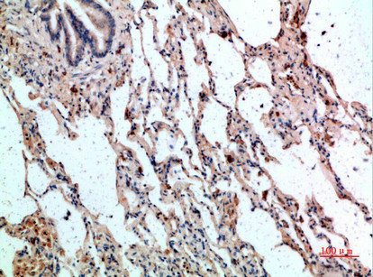 GYPC Antibody