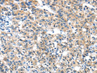 GZMK Antibody