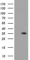 H6PD Antibody