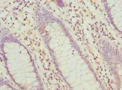HABP2 Antibody