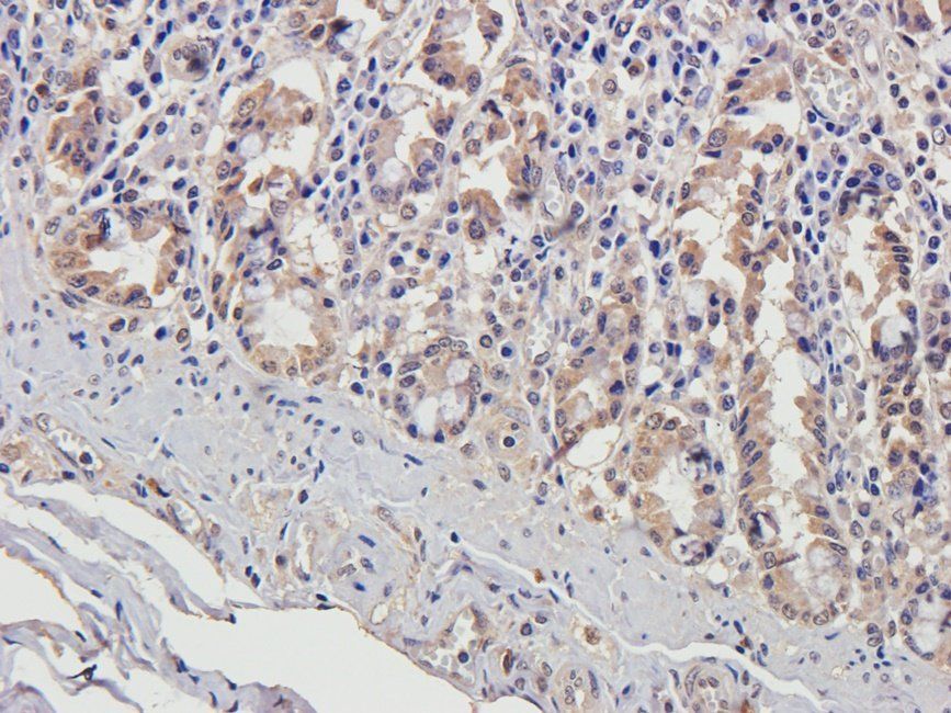 HAND1 Rabbit Polyclonal Antibody