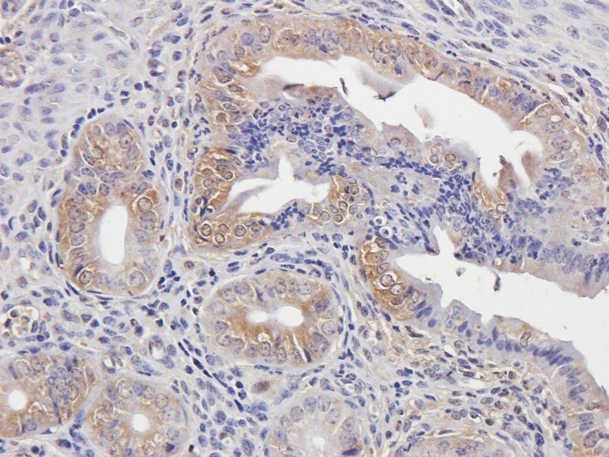 HAND1 Rabbit Polyclonal Antibody