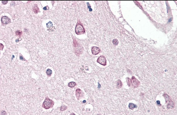 Goat anti-HAP1 Antibody