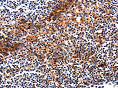 HP Antibody