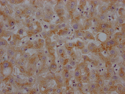 HP Antibody