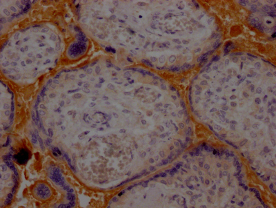 HP Antibody