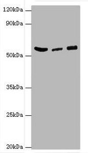 HARS Antibody