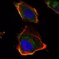 HAS1 Antibody