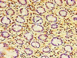 HAUS6 Antibody