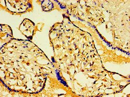 HAUS6 Antibody