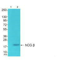 CGB Antibody