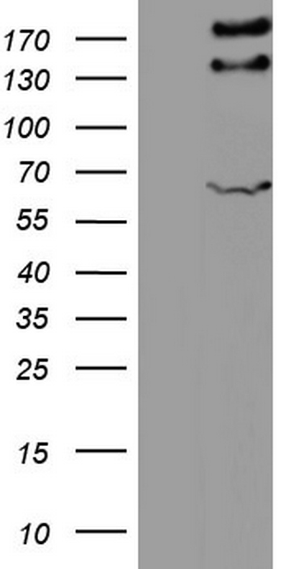 hCG beta Antibody