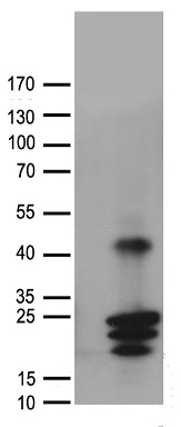 hCG beta Antibody