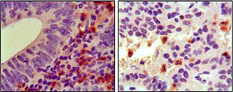 HCK Antibody