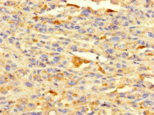 HDAC1 Antibody