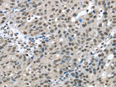 HDAC1 Antibody