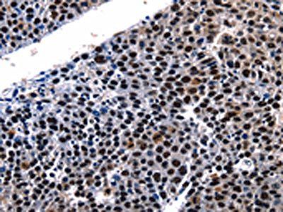 HDAC1 Antibody