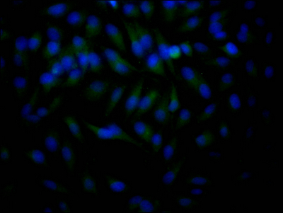 HDAC2 Antibody