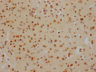 HDAC2 Antibody