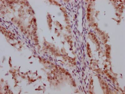 HDAC3 Antibody