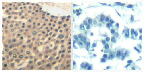 HDAC4/HDAC5/HDAC9 Antibody