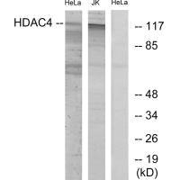HDAC4 Antibody