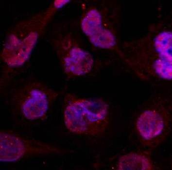 HDAC4 (Ab-632) Antibody