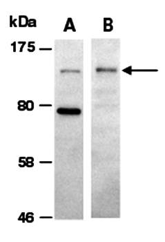 HDAC4 (vPairTM) Antibodies